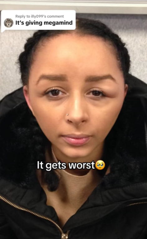 Woman dyes hair and nearly dies: See what happened to her head