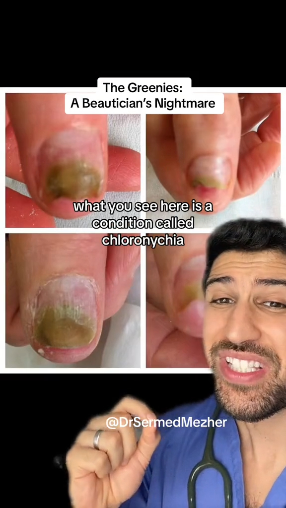 Think twice: Doctor reveals alarming consequences of nail extension