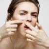 Dermatologists warn: These anti-blackhead methods destroy your skin barrier