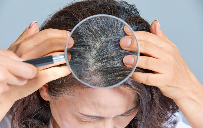 Is it possible to stop early hair graying? Trichologist explains