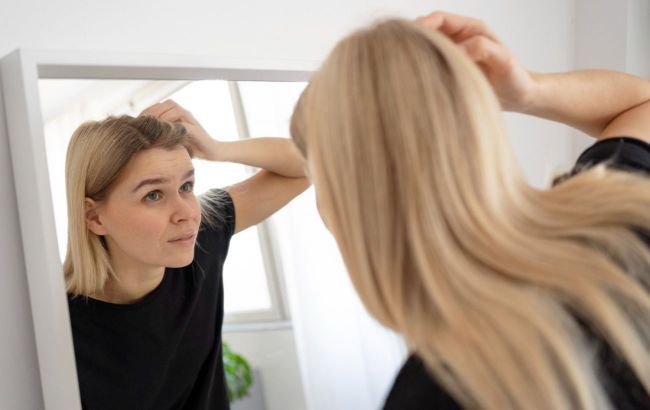 Hair loss can be treated with vitamins: True or false?