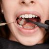 Wisdom teeth aren't always trouble: Dentist explains when to keep them