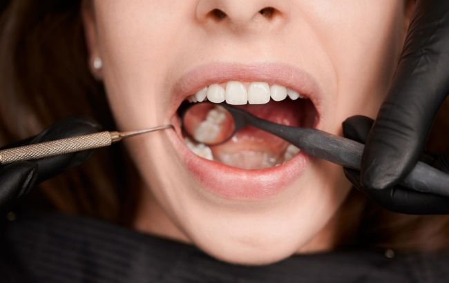 Wisdom teeth aren't always trouble: Dentist explains when to keep them