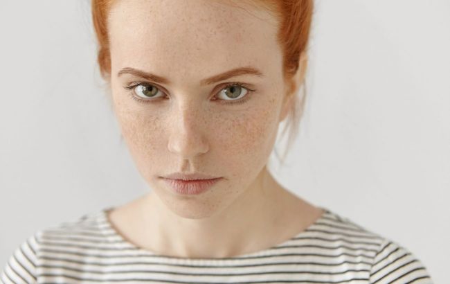 Doctor warns against harmful method for 'whitening' freckles on face