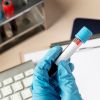 Can DNA test predict your cancer risk? Geneticist explains