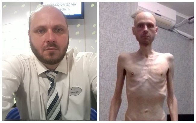 What Ukrainain soldier looks like after 20 months in Russian captivity