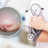 Doctor names 4 rules to fight liver obesity