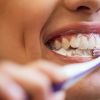 Link found between poor dental hygiene and fatal disease: New study