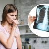 Doctor explains how to ease nighttime coughing