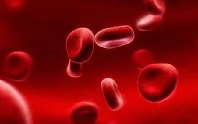 Doctor identifies causes of elevated hemoglobin and highlights actions to avoid