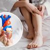 Visible symptoms of heart conditions: Signs on feet and toes