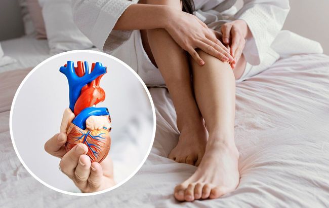 Visible symptoms of heart conditions: Signs on feet and toes