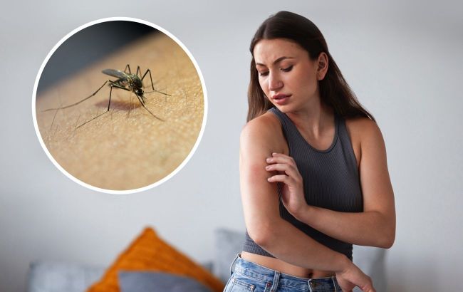 Insect bites season: Symptoms and treatment advice