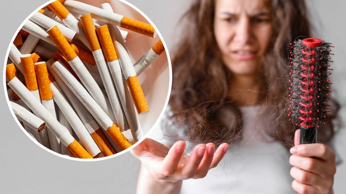 How smoking affects hair loss - Explanation from trichologist | RBC-Ukraine