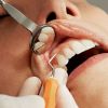How teeth deteriorate with age: Truth few talk about