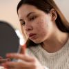 Dermatologist names products that can safely mask acne and psoriasis