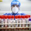 New COVID strains Nimbus and Stratus spreading in Ukraine with dozens infected